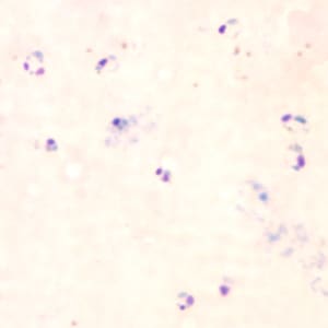 Pf_rings_thickD.jpg Figure D: Rings of <em>P. falciparum</em> in a thick blood smear.