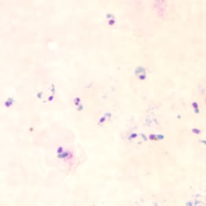 Pf_rings_thickE.jpg Figure E: Rings of <em>P. falciparum</em> in a thick blood smear.