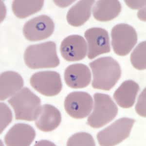 Pf_rings_thinC.jpg Figure I: Rings of <em>P. falciparum</em> in a thin blood smear.