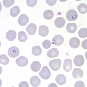 Pf_rings_thinD.jpg Figure J: Rings of <em>P. falciparum</em> in a thin blood smear.