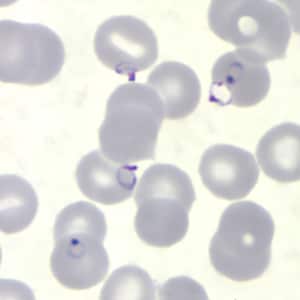 Pf_rings_thinE.jpg Figure K: Rings of <em>P. falciparum</em> in a thin blood smear.