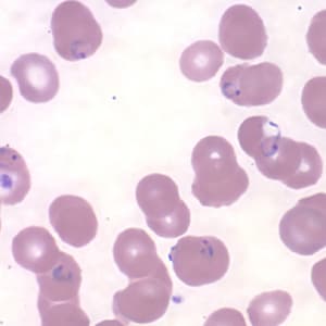 Pf_rings_thinF_AZPHL.jpg Figure L: Rings of <em>P. falciparum</em> in a thin blood smear. Image courtesy of the Arizona State Public Health Laboratory.