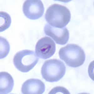 Figure B: