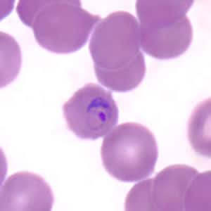 Pm_ring_thinC.jpg Figure D: Ring-form trophozoite of <em>P. malariae</em> in a thin blood smear.