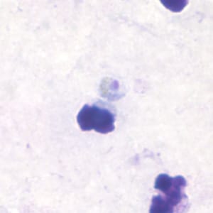 Pm_troph_thickB.jpg Figure B: Trophozoite of <em>P. malariae</em> in a thick blood smear.