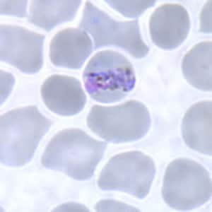 Pm_bandB.jpg Figure B: Band-form trophozoite of <em>P. malariae</em> in a thin blood smear.