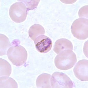 Pm_bandC.jpg Figure C: Band-form trophozoite of <em>P. malariae</em> in a thin blood smear.