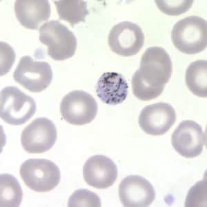 Pm_gametocyte_thinB.jpg Figure D: Gametocyte of <em>P. malariae</em> in a thin blood smear.