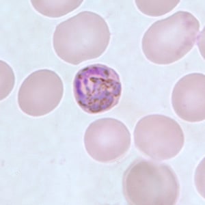 Pm_gametocyte_thinC.jpg Figure E: Developing gametocyte of <em>P. malariae</em> in a thin blood smear.
