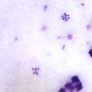 Pm_schizont_thickC.jpg Figure C: Schizonts of <em>P. malariae</em> in a thick blood smear.