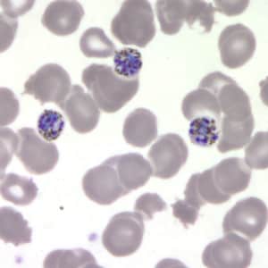 Pm_schizont_thinA.jpg Figure E: Schizonts of <em>P. malariae</em> in a thin blood smear.