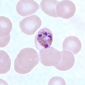 Pm_schizont_thinB.jpg Figure F: Schizont of <em>P. malariae</em> in a thin blood smear.
