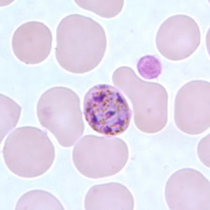 Pm_schizont_thinC.jpg Figure G: Schizont of <em>P. malariae</em> in a thin blood smear.