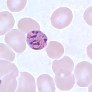 Pm_schizont_thinD.jpg Figure H: Schizont of <em>P. malariae</em> in a thin blood smear.
