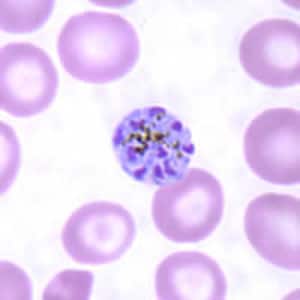 Pm_schizont_thinE.jpg Figure I: Schizont of <em>P. malariae</em> in a thin blood smear.