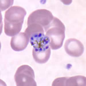 Pm_schizont_thinF.jpg Figure J: Schizont of <em>P. malariae</em> in a thin blood smear.