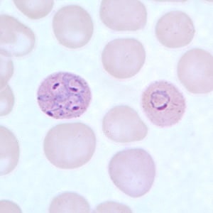 Po_rings_thinA.jpg Figure C: Ring-form trophozoites of <em>P. ovale</em> in a thin blood smear. Note the multiply-infected RBC in this image.