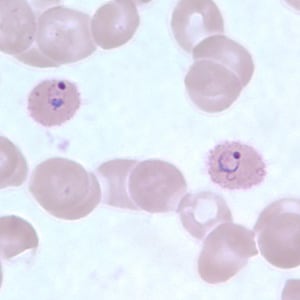 Po_rings_thinB.jpg Figure D: Ring-form trophozoites of <em>P. ovale</em> in a thin blood smear.