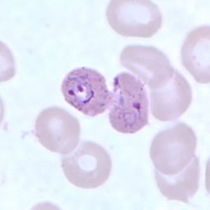 Po_troph_thinD.jpg Figure E: Trophozoites of <em>P. ovale</em> in a thin blood smear.
