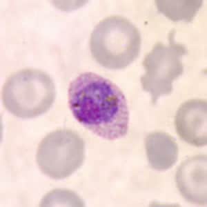 Po_gametocyte_thinA.jpg Figure C: Microgametocyte of <em>P. ovale</em> in a thin blood smear. Note the elongated, oval shape and the Schüffner's dots.