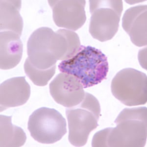 Po_gametocyte_thinD.jpg Figure F: Macrogametocyte of <em>P. ovale</em> in a thin blood smear, showing Schüffner's dots.