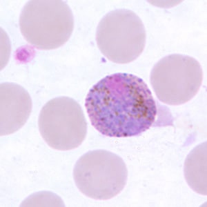 Po_gametocyte_thinF.jpg Figure H: Macrogametocyte of <em>P. ovale</em> in a thin blood smear.