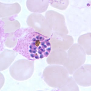 Po_schizont_thinC.jpg Figure F: Schizont of <em>P. ovale</em> in a thin blood smear.