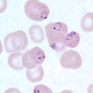 Pf_MaurersC.jpg Figure C: Ring-form trophozoites of <em>P. falciparum</em> in a thin blood smear, exhibiting Maurer's clefts.