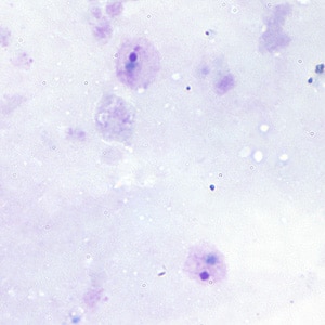 Pv_rings_thickA.jpg Figure A: Ring-form trophozoites of <em>P. vivax</em> in a thick blood smear.