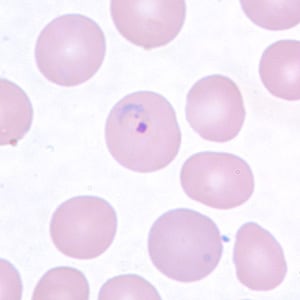 Pv_rings_thinA.jpg Figure C: Ring-form trophozoite of <em>P. vivax</em> in a thin blood smear.