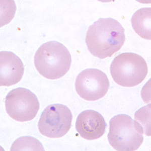 Pv_rings_thinB.jpg Figure D: Ring-form trophozoites of <em>P. vivax</em> in a thin blood smear.