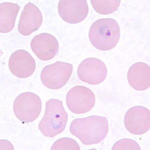 Pv_rings_thinD.jpg Figure F: Ring-form trophozoites of <em>P. vivax</em> in a thin blood smear.