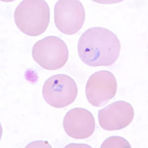 Pv_rings_thinE.jpg Figure G: Ring-form trophozoites of <em>P. vivax</em> in a thin blood smear.