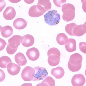 Pv_gametocyte_thinA.jpg Figure C: Macrogametocytes of <em>P. vivax</em> in a thin blood smear. Note the enlargement of the gametocytes compared to uninfected RBCs.