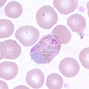 Pv_gametocyte_thinB.jpg Figure D: Macrogametocyte of <em>P. vivax</em> in a thin blood smear. Note the enlargement of the gametocytes compared to uninfected RBCs.