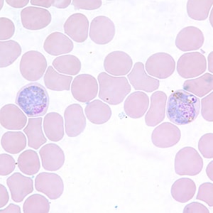 Pv_gametocyte_thinE.jpg Figure G: Macrogametocytes of <em>P. vivax</em> in a thin blood smear.