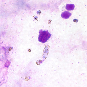 Pv_ookinete_thickA.jpg Figure A: Ookinete of <em>P. vivax</em> in a thick blood smear.