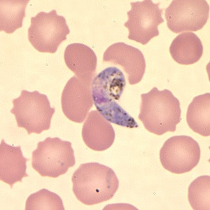 Pv_ookinete_thinA.jpg Figure D: Ookinete of <em>P. vivax</em> in a thin blood smear.