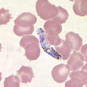 Pv_ookinete_thinB.jpg Figure E: Ookinete of <em>P. vivax</em> in a thin blood smear.
