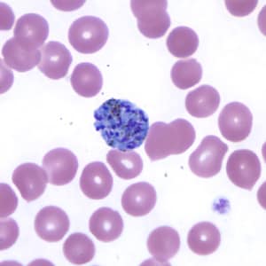 Pv_schizont_thinA.jpg Figure F: Schizont of <em>P. vivax</em> in a thin blood smear.