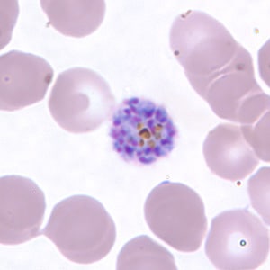 Pv_schizont_thinC.jpg Figure H: Schizont of <em>P. vivax</em> in a thin blood smear.