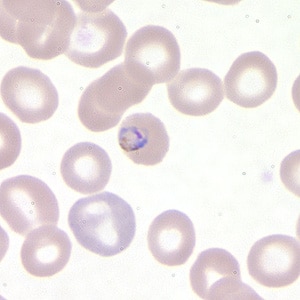 Pf_troph_thinA.jpg Figure B: Trophozoite of <em>P. falciparum</em> in a thin blood smear.