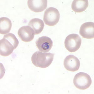 Pf_troph_thinB.jpg Figure C: Trophozoite of <em>P. falciparum</em> in a thin blood smear.