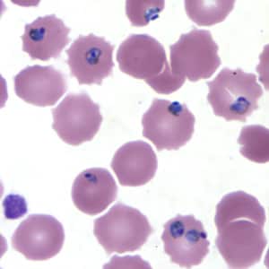 Pf_troph_thinD.jpg Figure E: Trophozoites of <em>P. falciparum</em> in a thin blood smear.