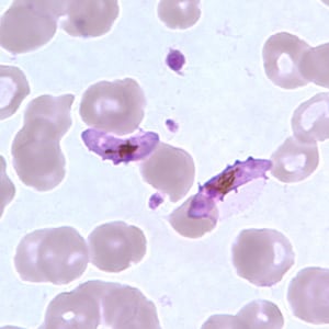 Pf_gametocyte_thinD.jpg Figure G: Gametocytes of <em>P. falciparum</em> in a thin blood smear. In these specimens, Laveran's bibs can be seen.