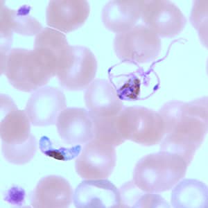 Pf_gametocyte_thinF.jpg Figure I: Gametocytes of <em>P. falciparum</em> in a thin blood smear. The gametocyte in the upper right is undergoing exflagellation, a process that normally occurs in the mid-gut of the mosquito host. However, it may be observed in human blood specimens when there is a delay in processing the blood.