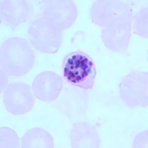 Pf_schizont_thinA.jpg Figure A: Schizont of <em>P. falciparum</em> in a thin blood smear.