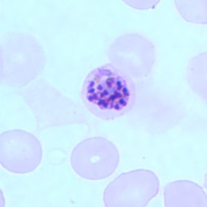 Pf_schizont_thinB.jpg Figure B: Schizont of <em>P. falciparum</em> in a thin blood smear.