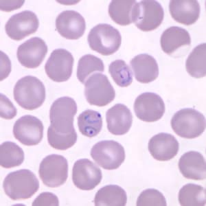 Pk_rings_thin_NY1.jpg Figure A: Ring-form trophozoites of <em>P. knowlesi</em> in a Giemsa-stained thin blood smear from a human patient that traveled to the Philippines. Note a multiply-infected RBC in this image. Image courtesy of the Wadsworth Center, New York State Department of Health.
