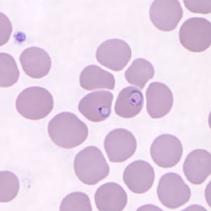 Pk_rings_thin_NY4.jpg Figure D: Ring-form trophozoites of <em>P. knowlesi</em> in a Giemsa-stained thin blood smear from a human patient that traveled to the Philippines. Image courtesy of the Wadsworth Center, New York State Department of Health.